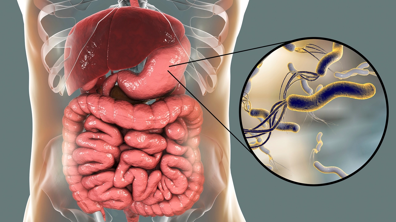 The Connection between Stomach Ulcers and Helicobacter pylori Infection