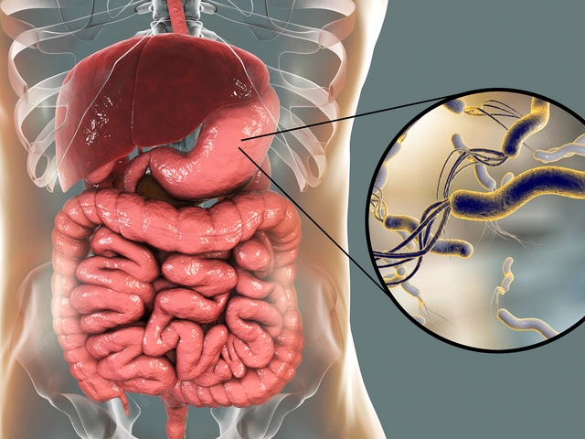 The Connection between Stomach Ulcers and Helicobacter pylori Infection